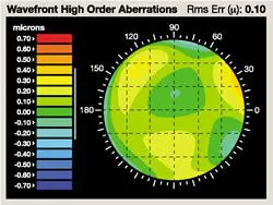 Wave Front LASIK