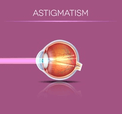 Example of Astigmatism