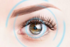 LASIK Eye Surgery