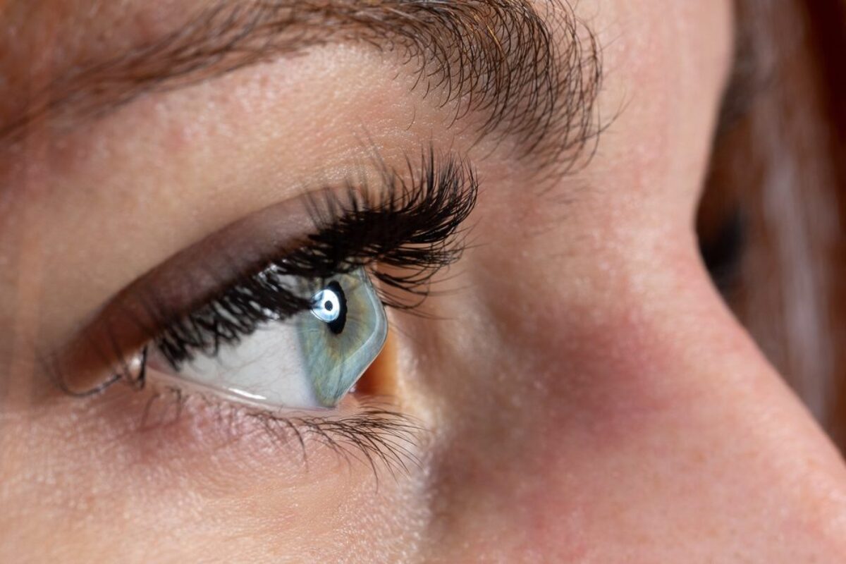 Keratoconus Symptoms & Treatments | Toledo LASIK