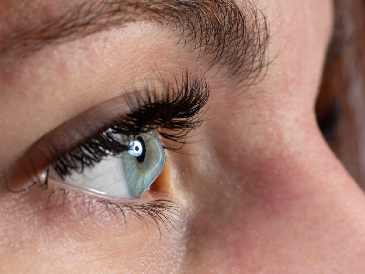 How to Get Rid of Puffy Eyes  Will Vision and Lasik Centers